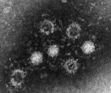Ｅ型肝炎ウイルスの電子顕微鏡写真（国立感染症研究所提供）