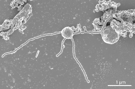 熊野灘の深海で見つかり、新たな「界」として認められた古細菌（海洋研究開発機構提供）