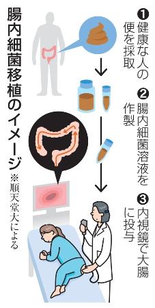 腸内細菌移植のイメージ